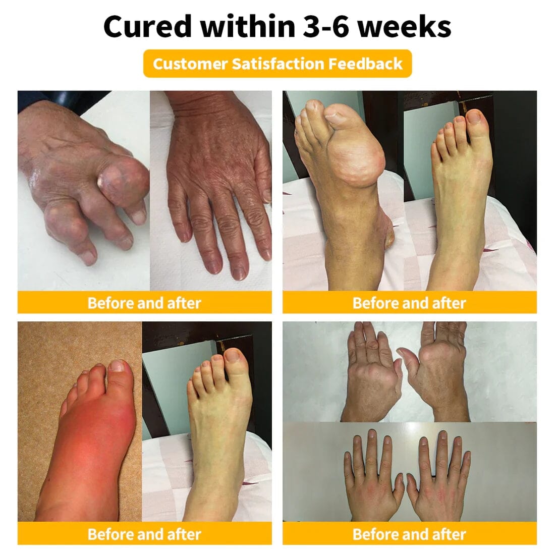Flysmusβ’ Bee Venom Pain-Relief Bone Healing Creamππ π