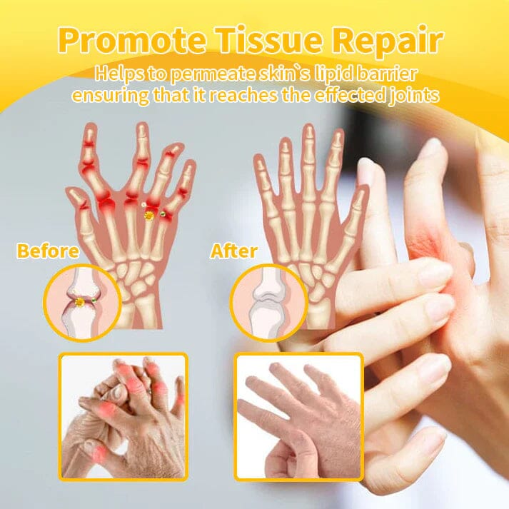 Flysmusβ’ Bee Venom Pain-Relief Bone Healing Creamππ π
