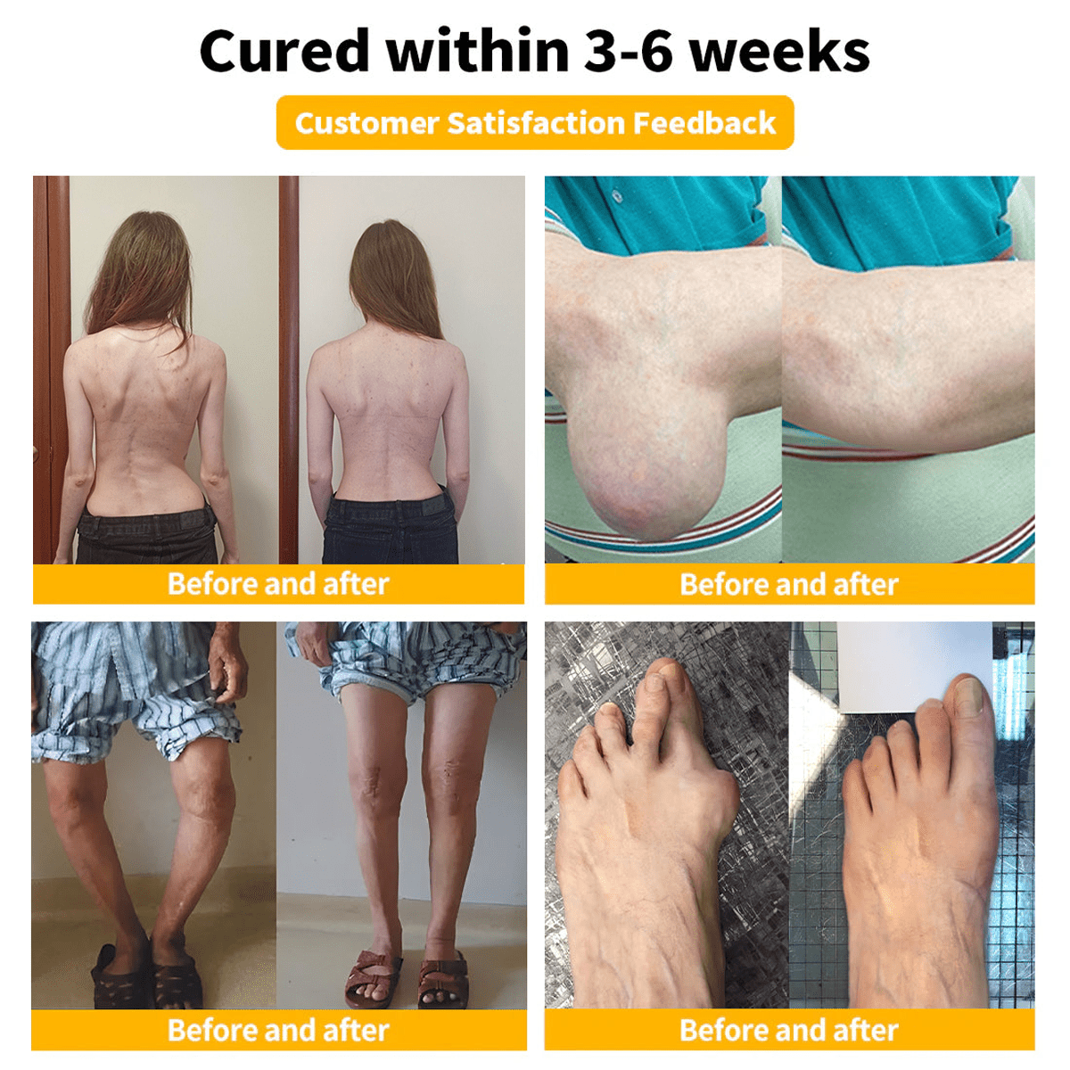 Flysmusβ’ Bee Venom Pain-Relief Bone Healing Creamππ π