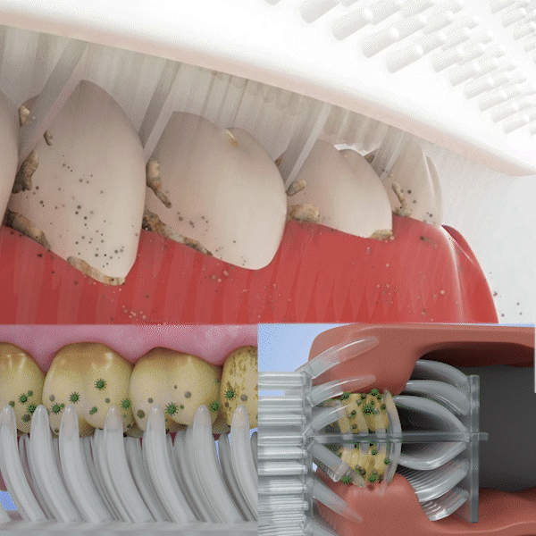 Remifa™ SpeedySmile EZBrush 360 U-Shape Toothbrush