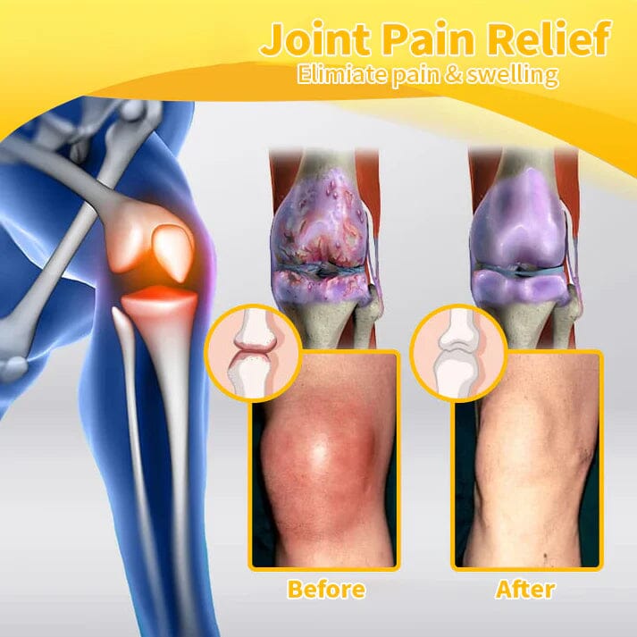 Flysmus™ Bee Venom Pain-Relief Bone Healing Cream(𝑷𝒓𝒐𝒗𝒊𝒅𝒆𝒔 𝒑𝒂𝒊𝒏 𝒆𝒍𝒊𝒎𝒊𝒏𝒂𝒕𝒆 𝒇𝒐𝒓 𝑨𝒓𝒕𝒉𝒓𝒊𝒕𝒊𝒔, 𝑴𝒖𝒔𝒄𝒍𝒆, 𝑩𝒂𝒄𝒌 𝑷𝒂𝒊𝒏, 𝑲𝒏𝒆𝒆𝒔, 𝑩𝒂𝒄𝒌, 𝑺𝒉𝒐𝒖𝒍𝒅𝒆𝒓𝒔, 𝑯𝒊𝒑𝒔, 𝑾𝒓𝒊𝒔𝒕𝒔, 𝑯𝒂𝒏𝒅𝒔)🐝