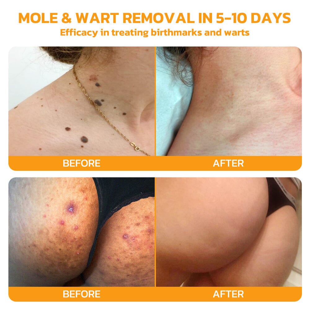 Therapeutic Products Directorate (TPD)✅ Furzero™ Bee Venom Skincare Treatment Pads (⚕️AAD Recommended)